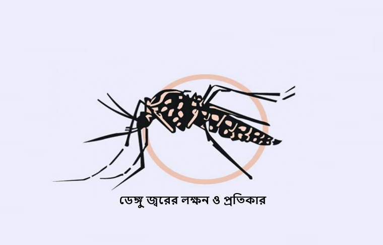 ডেঙ্গু জ্বরের লক্ষন ও প্রতিকার